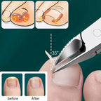 Nail Clipper, Professional Thick & Ingrown Toenail Correction Tool, Pedicure Clippers Toe Nail Cutter for Men & Women, Super Sharp Curved Blade Grooming Tool | Multi |