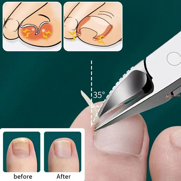 Nail Clipper, Professional Thick & Ingrown Toenail Correction Tool, Pedicure Clippers Toe Nail Cutter for Men & Women, Super Sharp Curved Blade Grooming Tool | Multi |