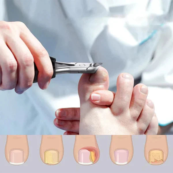 Nail Clipper, Professional Thick & Ingrown Toenail Correction Tool, Pedicure Clippers Toe Nail Cutter for Men & Women, Super Sharp Curved Blade Grooming Tool | Multi |